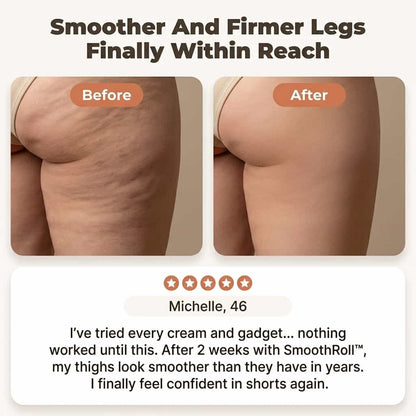SmoothRoll™ - 360 Degree Cellulite Reducer