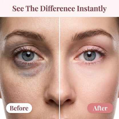 PureTone™ - Instant Brightening Under Eye Cream for Dark Circles