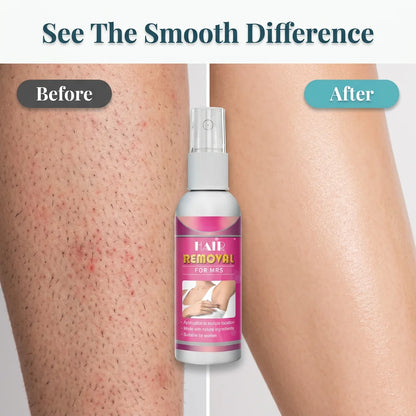 SoftMist™ - Gentle Hair Removal Spray, Pack of 2