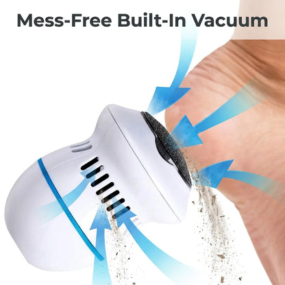 CallusClear™ - Rechargeable Electric Foot Smoother for Soft Skin