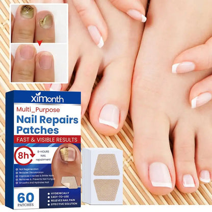 HealthyNail™ Fungal Nail Restoration Patches - Restore Clear, Healthy Nails Discreetly